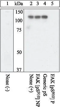 WB analysis of human epithelial carcinoma cells expressing FAK with (Lane 2-5) or without (Lane 1) 100 ng/mL Taxol for 18-24 hours in serum-free media using GTX24794 FAK (phospho Ser910) antibody. The data show that only the immunogen phosphopeptide blocks the signal, demonstrating the specificity of the antibody.