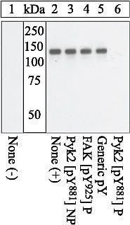 WB analysis of pervanadate-treated primary chicken embryo fibroblasts plated on fibronectin,either mock-transfected (Lane 1) or transfected with a Pyk2 expression vector (Lane 2-6) using GTX24801 PYK2 (phospho Tyr881) antibody.