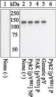 WB analysis of pervanadate-treated primary chicken embryo fibroblasts plated on fibronectin, either mock-transfected (Lane 1) or transfected with a Pyk2 expression vector (Lane 2-6) using GTX24801 PYK2 (phospho Tyr881) antibody. The data show that only the immunogen phosphopeptide blocks the signal, demonstrating the specificity of the antibody. WB analysis of pervanadate-treated primary chicken embryo fibroblasts plated on fibronectin, either mock-transfected (Lane 1) or transfected with a Pyk2 expression vector (Lane 2-6) using GTX24801 PYK2 (phospho Tyr881) antibody. The data show that only the immunogen phosphopeptide blocks the signal, demonstrating the specificity of the antibody.