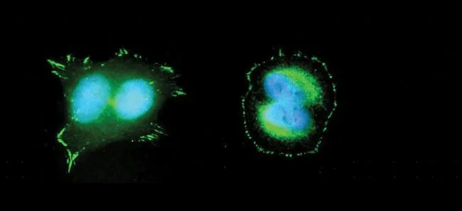 ICC/IF analysis of HeLa cells using GTX24803 FAK (phospho Tyr397) antibody. Green : Primary antibody Blue : cell nucleus Fixation/Permeabilization : ice-cold 95% methanol