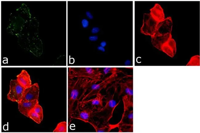 ICC/IF analysis of A549 cells using GTX24804 FAK (phospho Tyr861) antibody. Panel e is a no primary antibody control. Green : Primary antibody Blue : Nuclei Red : Actin Fixation : 4% paraformaldehyde Permeabilization : 0.25% Triton X-100 for 10 minutes Dilution : 1 microg/ml in 1% BSA incubated for 3 hours at room temperature