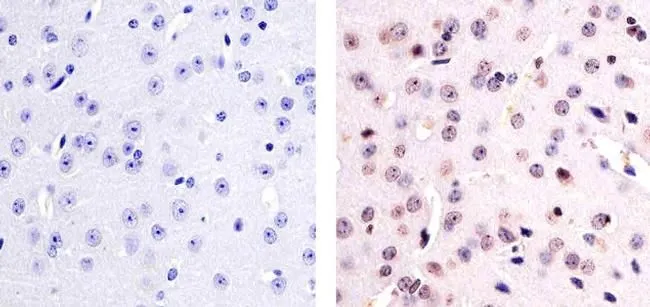 IHC-P analysis of human brain tissue using GTX24805 PYK2 (phospho Tyr579) antibody. Right : Primary antibody Left : Negative control without primary antibody Antigen retrieval : 10mM sodium citrate (pH 6.0), microwaved for 8-15 min Dilution : 1:20