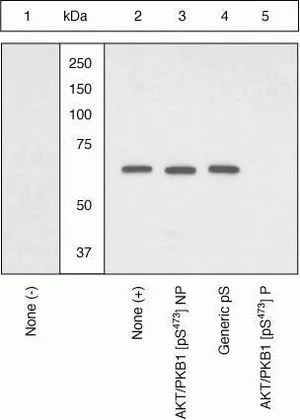 WB (peptide competition) analysis of primary chicken embryo fibroblasts expressing Pyk2 plated on fibronectin using GTX24805 PYK2 (phospho Tyr579) antibody prior incubated with the non-phosphopeptide corresponding to the phosphopeptide immunogen (Lane 3), a generic phosphotyrosine-containing peptide (Lane 4), or the phosphopeptide immunogen (Lane 5). The data show that only the immunogen phosphopeptide blocks the signal, demonstrating the specificity of the antibody.