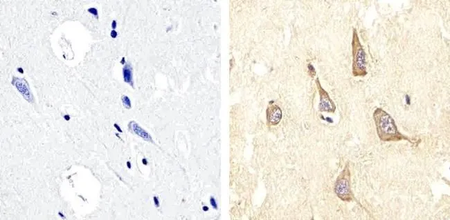 IHC-P analysis of human brain tissue using GTX24807 PYK2 (phospho Tyr579/Tyr580) antibody. Right : Primary antibody Left : Negative control without primary antibody Antigen retrieval : 10mM sodium citrate (pH 6.0), microwaved for 8-15 min Dilution : 1:20 IHC-P analysis of human brain tissue using GTX24807 PYK2 (phospho Tyr579/Tyr580) antibody. Right : Primary antibody Left : Negative control without primary antibody Antigen retrieval : 10mM sodium citrate (pH 6.0), microwaved for 8-15 min Dilution : 1:20