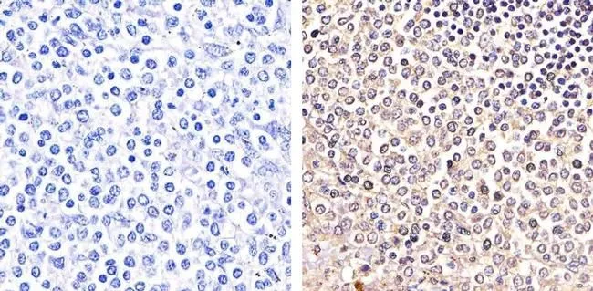 IHC-P analysis of human spleen tissue using GTX24807 PYK2 (phospho Tyr579/Tyr580) antibody. Right : Primary antibody Left : Negative control without primary antibody Antigen retrieval : 10mM sodium citrate (pH 6.0), microwaved for 8-15 min Dilution : 1:20