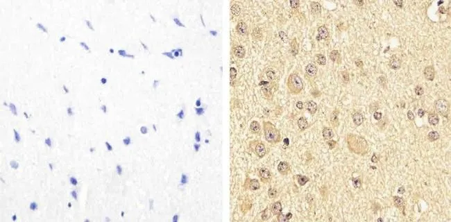 IHC-P analysis of mouse brain tissue using GTX24807 PYK2 (phospho Tyr579/Tyr580) antibody. Right : Primary antibody Left : Negative control without primary antibody Antigen retrieval : 10mM sodium citrate (pH 6.0), microwaved for 8-15 min Dilution : 1:20