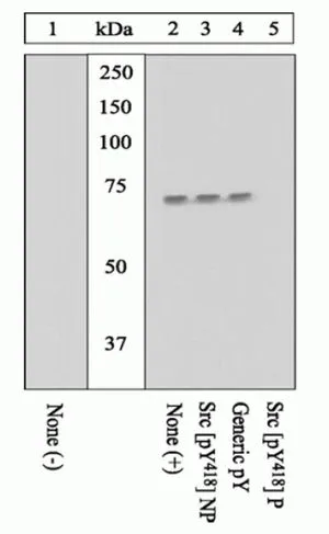 WB analysis of samples using GTX24816 Src (phospho Tyr416) antibody. The data show that only the immunogen phosphopeptide blocks the signal,demonstrating the specificity of the antibody.
