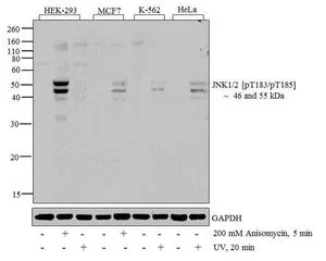 ICC/IF analysis of A549 cells treated with Anisomycin (25 ug/mL for 30 min) using GTX24821 JNK (phospho Thr183/Tyr185) antibody.