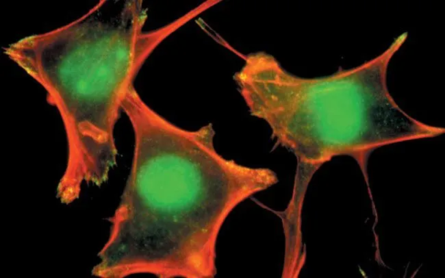 ICC/IF analysis of fibroblasts using GTX24828 PLCG1 (phospho Tyr783) antibody. Green : Primary antibody Red : Actin ICC/IF analysis of fibroblasts using GTX24828 PLCG1 (phospho Tyr783) antibody. Green : Primary antibody Red : Actin