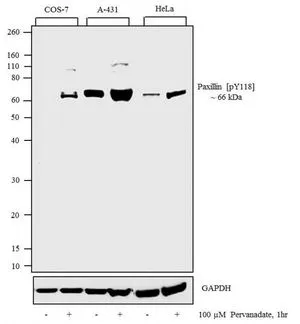 WB analysis of samples using GTX24833 Paxillin (phospho Tyr118) antibody. The data show that only the immunogen phosphopeptide blocks the signal,demonstrating the specificity of the antibody.
