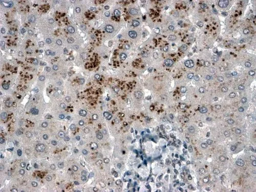 IHC-P analysis of human liver using GTX24850 USP15 antibody, C-term. Antigen retrieval : citrate buffer pH 6 Dilution : 2microg/ml IHC-P analysis of human liver using GTX24850 USP15 antibody, C-term. Antigen retrieval : citrate buffer pH 6 Dilution : 2microg/ml