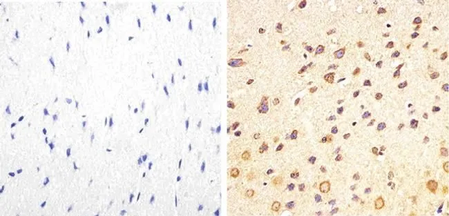 IHC-P analysis of mouse brain tissue using GTX24851 Tau (phospho Thr217) antibody. Right : Primary antibody Left : Negative control without primary antibody Antigen retrieval : 10mM sodium citrate (pH 6.0),microwaved for 8-15 min Dilution : 1:50