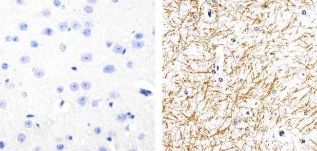 IHC-P analysis of mouse brain tissue using GTX24856 Tau (phospho Ser262) antibody. Right : Primary antibody Left : Negative control without primary antibody Antigen retrieval : 10mM sodium citrate (pH 6.0), microwaved for 8-15 min Dilution : 1:20