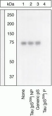WB (peptide competition) analysis of human recombinant Tau treated with PKA (36 microg per microg Tau) for 45 minutes and added to background extracts using GTX24857 Tau (phospho Ser356) antibody prior incubated with the non-phosphopeptide corresponding to the phosphopeptide immunogen (Lane 2), a generic phosphoserine-containing peptide (Lane 3), or the phosphopeptide immunogen (Lane 4). The data show that only the immunogen phosphopeptide blocks the signal, demonstrating the specificity of the antibody. WB (peptide competition) analysis of human recombinant Tau treated with PKA (36 microg per microg Tau) for 45 minutes and added to background extracts using GTX24857 Tau (phospho Ser356) antibody prior incubated with the non-phosphopeptide corresponding to the phosphopeptide immunogen (Lane 2), a generic phosphoserine-containing peptide (Lane 3), or the phosphopeptide immunogen (Lane 4). The data show that only the immunogen phosphopeptide blocks the signal, demonstrating the specificity of the antibody.