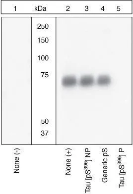 WB (peptide competition) analysis of human recombinant Tau treated with GSK-3 beta (1 ug per ug Tau) for 45 minutes (Lane 2-5) using GTX24858 Tau (phospho Ser396) antibody.