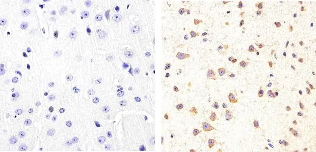 IHC-P analysis of mouse brain tissue using GTX24861 Tau (phospho Ser409) antibody. Right : Primary antibody Left : Negative control without primary antibody Antigen retrieval : 10mM sodium citrate (pH 6.0), microwaved for 8-15 min Dilution : 1:20 IHC-P analysis of mouse brain tissue using GTX24861 Tau (phospho Ser409) antibody. Right : Primary antibody Left : Negative control without primary antibody Antigen retrieval : 10mM sodium citrate (pH 6.0), microwaved for 8-15 min Dilution : 1:20