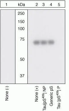 WB (peptide competition) analysis of human recombinant Tau treated with PKA (36 microg per microg Tau) for 1 hour (Lanes 2-5) using GTX24861 Tau (phospho Ser409) antibody prior incubated with the non-phosphopeptide corresponding to the phosphopeptide immunogen (Lane 3), a generic phosphoserine-containing peptide (Lane 4), or the phosphopeptide immunogen (Lane 5) control. The data show that only the immunogen phosphopeptide blocks the signal, demonstrating the specificity of the antibody.