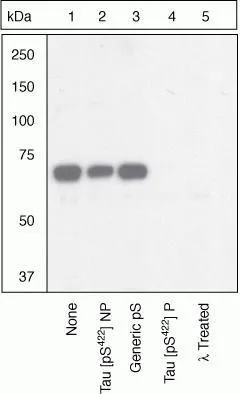 WB (peptide competition) analysis of human recombinant Tau stimulated with GSK-3 beta (1 microg per microg Tau) for 45 minutes using GTX24862 Tau (phospho Ser422) antibody prior incubated with the non-phosphopeptide corresponding to the non-phosphopeptide immunogen (Lane 2), a generic phosphoserine-containing peptide (Lane 3), or the phosphopeptide immunogen (Lane 4) control. The data show that only the immunogen phosphopeptide blocks the signal, demonstrating the specificity of the antibody. The membrane treated with phosphatase (Lane 5) eliminates the signal further verifying that the antibody is phospho-specific. WB (peptide competition) analysis of human recombinant Tau stimulated with GSK-3 beta (1 microg per microg Tau) for 45 minutes using GTX24862 Tau (phospho Ser422) antibody prior incubated with the non-phosphopeptide corresponding to the non-phosphopeptide immunogen (Lane 2), a generic phosphoserine-containing peptide (Lane 3), or the phosphopeptide immunogen (Lane 4) control. The data show that only the immunogen phosphopeptide blocks the signal, demonstrating the specificity of the antibody. The membrane treated with phosphatase (Lane 5) eliminates the signal further verifying that the antibody is phospho-specific.