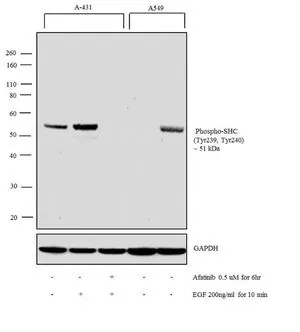 WB analysis of membrane enriched extracts (30 ug lysate) of A431 (Lane 1), A431 treated with EGF (200 ng/ml for 10 minutes) (Lane 2), A431 treated with Afatinib followed by EGF (0.5 uM for 6 hours, 200ng/ml for 10 minutes) (Lane 3), A549 (Lane 4), A549 treated with EGF (200 ng/ml for 10 minutes) (Lane 5) using GTX24890 SHC1 (phospho Tyr239/Tyr240) antibody. Dilution : 1:500