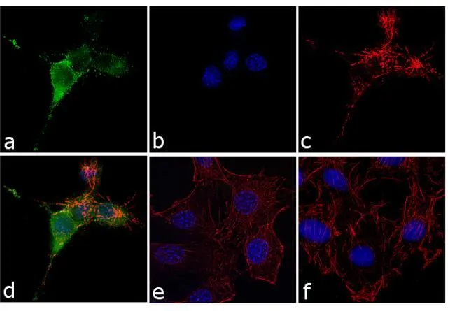 ICC/IF analysis of NIH-3T3 cells treated with 1.6 mM hydrogen peroxide for 1 h using GTX24904 Cortactin (phospho Tyr421) antibody. Panel e is untreated cell with no signal. Panel f represents control cells with no primary antibody to assess background. Green : Primary antibody Blue : Nuclei Red : Actin Fixation : 4% paraformaldehyde Permeabilization : 0.1% Triton X-100 for 10 minutes