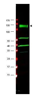 Western blot using GeneTex's affinity purified anti-FANCA antibody shows detection of a band at ~133 kDa (arrowhead) corres-ponding to FANCA in HeLa whole cell lysates.