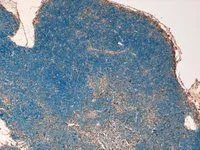 IHC-P analysis of mouse thymus using GTX25073 STAT3 (isoform 1/2) antibody, C-term. Antigen retrieval : Tris/EDTA buffer pH 9 Dilution : 4microg/ml IHC-P analysis of mouse thymus using GTX25073 STAT3 (isoform 1/2) antibody, C-term. Antigen retrieval : Tris/EDTA buffer pH 9 Dilution : 4microg/ml
