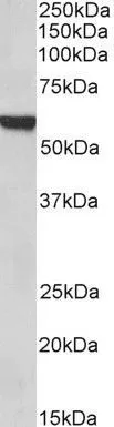 WB analysis of rat lung lysate using GTX25074 FOXA2 antibody, C-term. Dilution : 1microg/ml Loading : 35microg protein in RIPA buffer