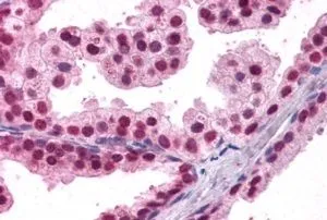 IHC-P analysis of human prostate using GTX25074 FOXA2 antibody, C-term. Antigen retrieval : citrate buffer pH 6 Dilution : 3.8microg/ml