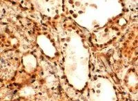 IHC-P analysis of human thyroid Gland using GTX25080 FOXE1 antibody, C-term. Antigen retrieval : Tris/EDTA buffer pH 9 Dilution : 2microg/ml