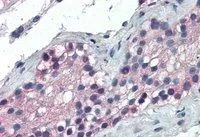IHC-P analysis of human testis using GTX25080 FOXE1 antibody, C-term. Antigen retrieval : Tris/EDTA buffer pH 9 Dilution : 5microg/ml