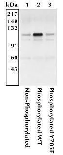 IP analysis of K562 cells transfected with human Integrin alphaV and wild-type (WT) or mutant (Y785F) human Integrin beta3 using GTX25191 Integrin beta 3 (phospho Tyr785) antibody. IP analysis of K562 cells transfected with human Integrin alphaV and wild-type (WT) or mutant (Y785F) human Integrin beta3 using GTX25191 Integrin beta 3 (phospho Tyr785) antibody.