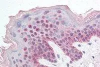 IHC-P analysis of human skin using GTX25199 FBXL10 antibody, C-term. Antigen retrieval : citrate buffer pH 6 Dilution : 5microg/ml IHC-P analysis of human skin using GTX25199 FBXL10 antibody, C-term. Antigen retrieval : citrate buffer pH 6 Dilution : 5microg/ml