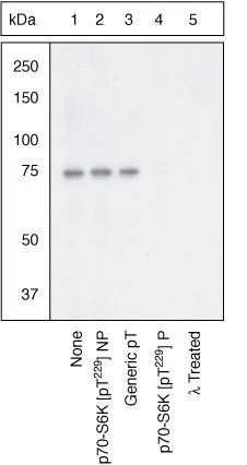 WB (peptide competition) analysis of Jurkat cells using GTX25231 p70 S6K (phospho Thr229) antibody prior incubated with the non-phosphorylated peptide corresponding to the phosphopeptide immunogen (Lane 2), a generic phosphothreonine-containing peptide (Lane 3), or the phosphopeptide immunogen (Lane 4). The data show that only the immunogen phosphopeptide blocks the signal, demonstrating the specificity of the antibody. The membrane treated with phosphatase (Lane 5) eliminates the signal further verifying that the antibody is phospho-specific. WB (peptide competition) analysis of Jurkat cells using GTX25231 p70 S6K (phospho Thr229) antibody prior incubated with the non-phosphorylated peptide corresponding to the phosphopeptide immunogen (Lane 2), a generic phosphothreonine-containing peptide (Lane 3), or the phosphopeptide immunogen (Lane 4). The data show that only the immunogen phosphopeptide blocks the signal, demonstrating the specificity of the antibody. The membrane treated with phosphatase (Lane 5) eliminates the signal further verifying that the antibody is phospho-specific.
