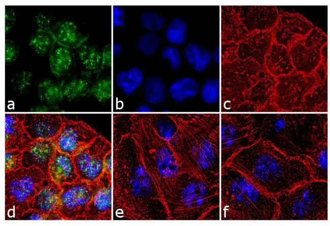 ICC/IF analysis of A431 cells treated with 200 ng/ml of EGF for 10 minutes using GTX25231 p70 S6K (phospho Thr229) antibody. Panel e is untreated cell with nuclear localization. Panel f represents control cells with no primary antibody to assess background. Green : Primary antibody Blue : Nuclei Red : Actin Fixation : 4% paraformaldehyde Permeabilization : 0.1% Triton X-100 for 10 minutes