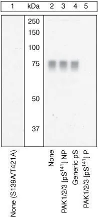 WB analysis of samples using GTX25247 PAK2 (phospho Ser141) antibody. The data show that only the immunogen phosphopeptide blocks the signal, demonstrating the specificity of the antibody.