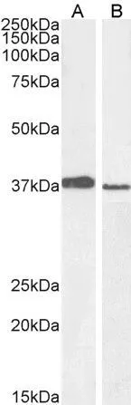 WB analysis of A549 (A) and PD19 (B) cell lysate using GTX25267 MEL18 antibody,C-term. Dilution : 1ug/ml Loading : 30ug protein in RIPA buffer