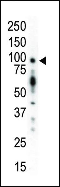 WB analysis of mouse kidney lysate using GTX25283 PKC mu antibody.