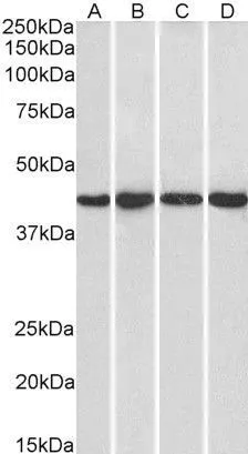 WB analysis of HeLa (A), HepG2 (B), Jurkat (C) and NIH-3T3 (D) nuclear lysates using GTX25300 NIPP1 antibody, C-term. Dilution : 1microg/ml Loading : 35microg protein in RIPA buffer WB analysis of HeLa (A), HepG2 (B), Jurkat (C) and NIH-3T3 (D) nuclear lysates using GTX25300 NIPP1 antibody, C-term. Dilution : 1microg/ml Loading : 35microg protein in RIPA buffer