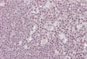 IHC-P analysis of human thymus using GTX25300 NIPP1 antibody, C-term. Antigen retrieval : citrate buffer pH 6 Dilution : 3.8microg/ml