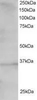 WB analysis of 293 lysate using GTX25311 TCF19 antibody, C-term. Dilution : 1.5microg/ml Loading : 30microg protein in RIPA buffer WB analysis of 293 lysate using GTX25311 TCF19 antibody, C-term. Dilution : 1.5microg/ml Loading : 30microg protein in RIPA buffer