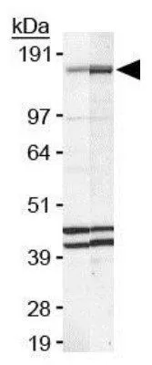WB analysis of MCF-7 (lane 1) and HeLa (lane 2) cell lysate using GTX25360 FANCD2 antibody [FI-17].