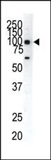 WB analysis of HeLa cell lysate using GTX25385 EphA1 antibody. WB analysis of HeLa cell lysate using GTX25385 EphA1 antibody.