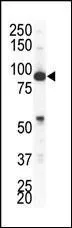 WB analysis of NCI-H460 cell lysate using GTX25396 EphA4 antibody. WB analysis of NCI-H460 cell lysate using GTX25396 EphA4 antibody.