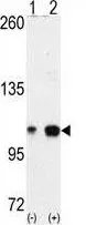 WB analysis of 293 cell lysate (2 ug/lane) either nontransfected (Lane 1) or transiently transfected with the EPHA4 (Lane 2) using GTX25396 EphA4 antibody.