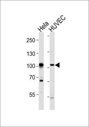 WB analysis of HeLa, HUVEC cell using GTX25396 EphA4 antibody. Loading : 20ug per lane Dilution : 1:1000