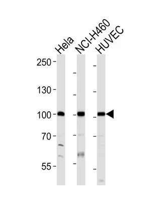 WB analysis of HeLa, NCI-H460, HUVEC cell using GTX25396 EphA4 antibody. Loading : 20ug per lane Dilution : 1:1000