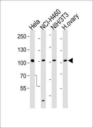 WB analysis of HeLa, NCI-H460, NIH3T3 cell and human ovary tissue lysate using GTX25396 EphA4 antibody. Loading : 35ug per lane Dilution : 1:1000