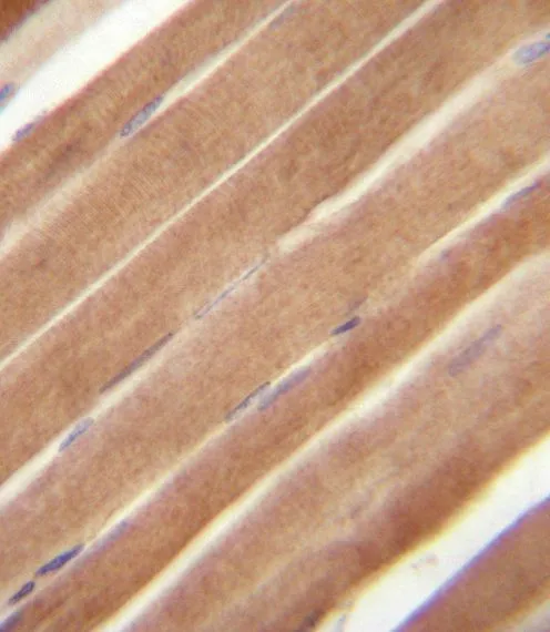 IHC-P analysis of human skeletal muscle using GTX25418 EphB2 antibody. IHC-P analysis of human skeletal muscle using GTX25418 EphB2 antibody.