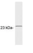 WB analysis of bovine rod outer segment lysate using GTX25420 GCAP1 antibody [G2].