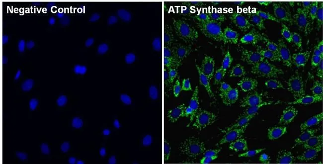 ICC/IF analysis of 3T3 cells using GTX25432 ATP5B antibody [4.3E8.D10]. Cells were probed without (left) or with(right) an antibody. Green : ATPSynthase beta (ATP5B ) Blue : Nuclei Red : Actin Fixation : 4% paraformaldehyde Dilution : 5 microg/ml for 1 hour at room temperature